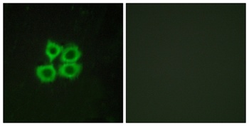 CRF-RII antibody