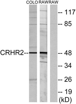 CRF-RII rabbit pAb