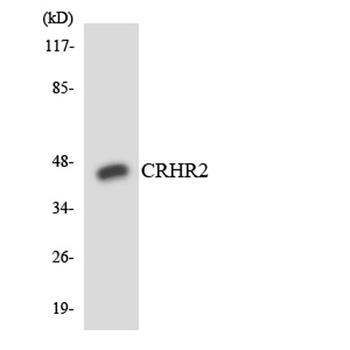 CRF-RII rabbit pAb
