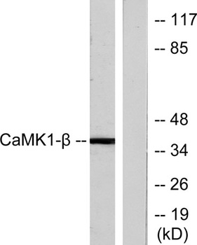 CaMKIβ rabbit pAb