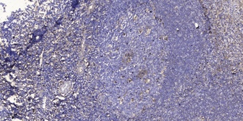 PAGE-3 rabbit pAb Antibody
