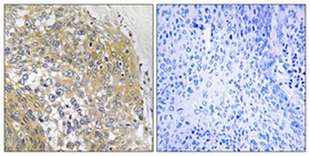 S-100A16 antibody