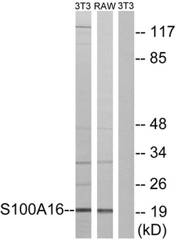 S-100A16 antibody