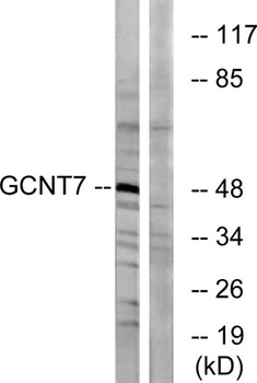 GCNT7 rabbit pAb