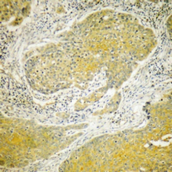Dynein LC 2 rabbit pAb