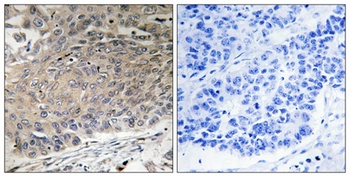 Dynein LC 2 rabbit pAb