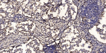 Polyclonal AntibodyP5 antibody