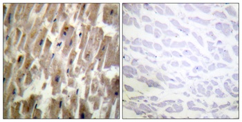 Crystallin-αB (phospho Ser45) rabbit pAb