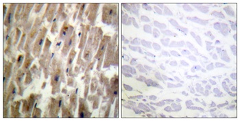 Crystallin-alphaB (phospho-Ser45) antibody