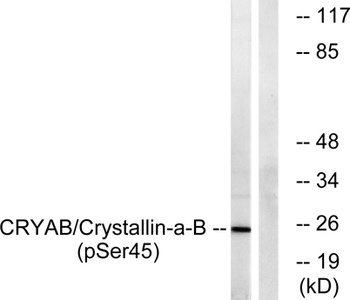 Crystallin-alphaB (phospho-Ser45) antibody