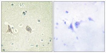 c-Fms (phospho-Tyr723) antibody