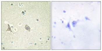 c-Fms (phospho Tyr723) rabbit pAb