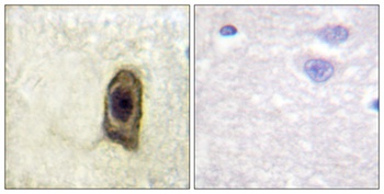 c-Fms (phospho Tyr561) rabbit pAb