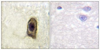 c-Fms (phospho-Tyr561) antibody