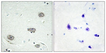 c-Fms (phospho Tyr809) rabbit pAb