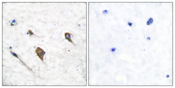 IL3Rbeta (phospho-Tyr593) antibody