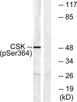 Csk (phospho Ser364) rabbit pAb