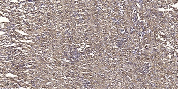 Csk (phospho-Ser364) antibody