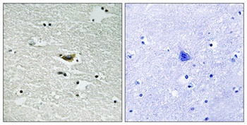Casein Kinase Ialpha (phospho-Tyr294) antibody
