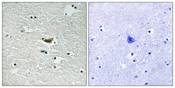 Casein Kinase Iα (phospho Tyr294) rabbit pAb