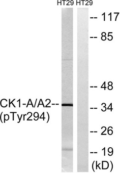 Casein Kinase Ialpha (phospho-Tyr294) antibody