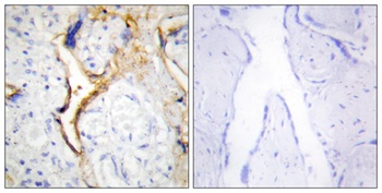 Casein Kinase IEpsilon antibody