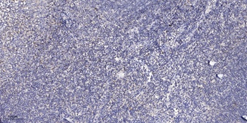 PTGR2 rabbit pAb