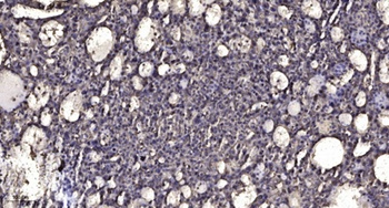 Casein Kinase Iγ2 rabbit pAb