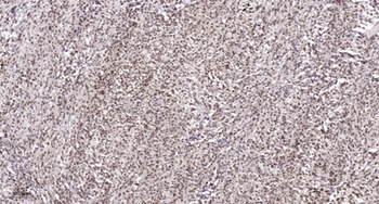 Casein Kinase IIα (phospho Tyr255) rabbit pAb