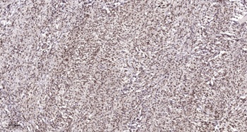 Casein Kinase II alpha (phospho-Tyr255) antibody