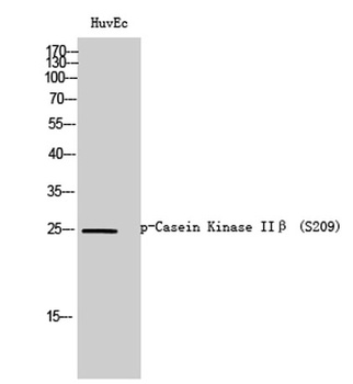Casein Kinase IIβ (phospho Ser209) rabbit pAb