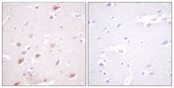 Casein Kinase IIβ (phospho Ser209) rabbit pAb