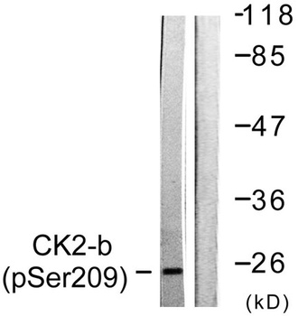 Casein Kinase II beta (phospho-Ser209) antibody