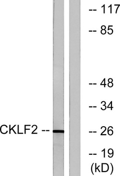 CMTM2 rabbit pAb