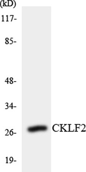 CMTM2 rabbit pAb