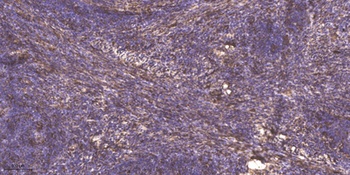 Neurocan antibody