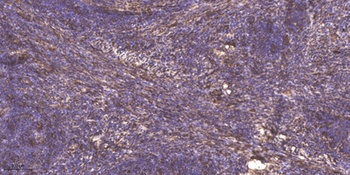 Neurocan rabbit pAb