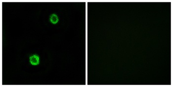 Cystatin SN rabbit pAb