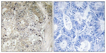 Cystatin SN rabbit pAb