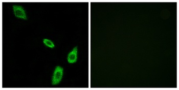 AR-alpha1B antibody