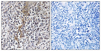 TMC8 rabbit pAb