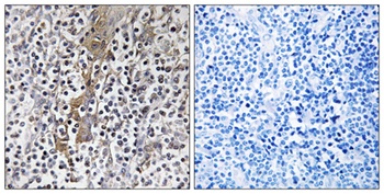 TMC8 antibody