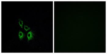 AR-alpha 1A antibody