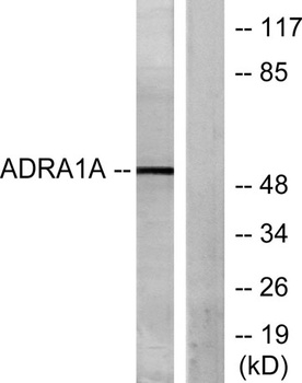 AR-alpha 1A antibody