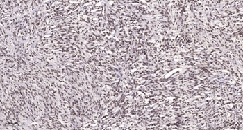 AR-α1A rabbit pAb