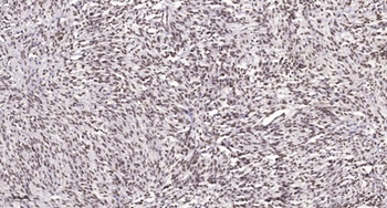 AR-alpha 1A antibody