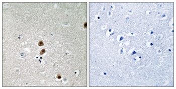 CtBP1 (phospho Ser422) rabbit pAb