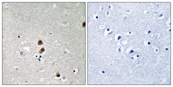 CtBP1 (phospho-Ser422) antibody