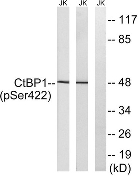 CtBP1 (phospho-Ser422) antibody