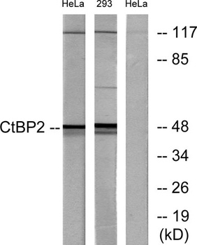 CtBP2 antibody